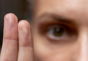 Therapist performing EMDR